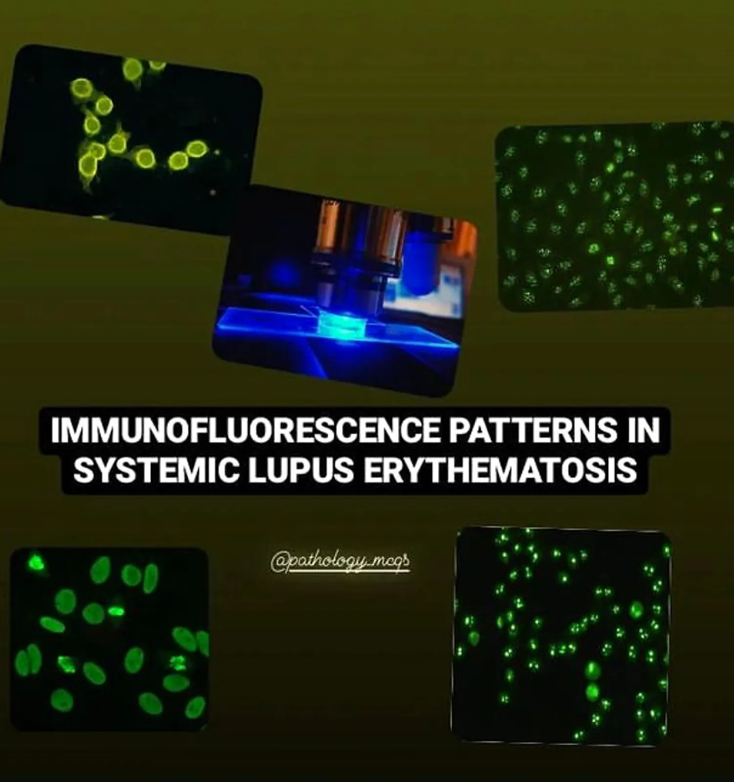 Common ANA immunofluorescence patterns