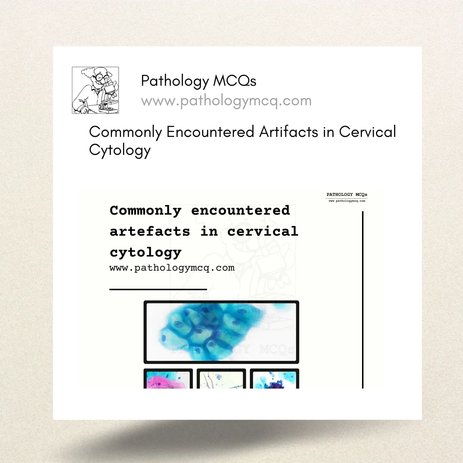 Commonly Encountered Artifacts in Cervical Cytology