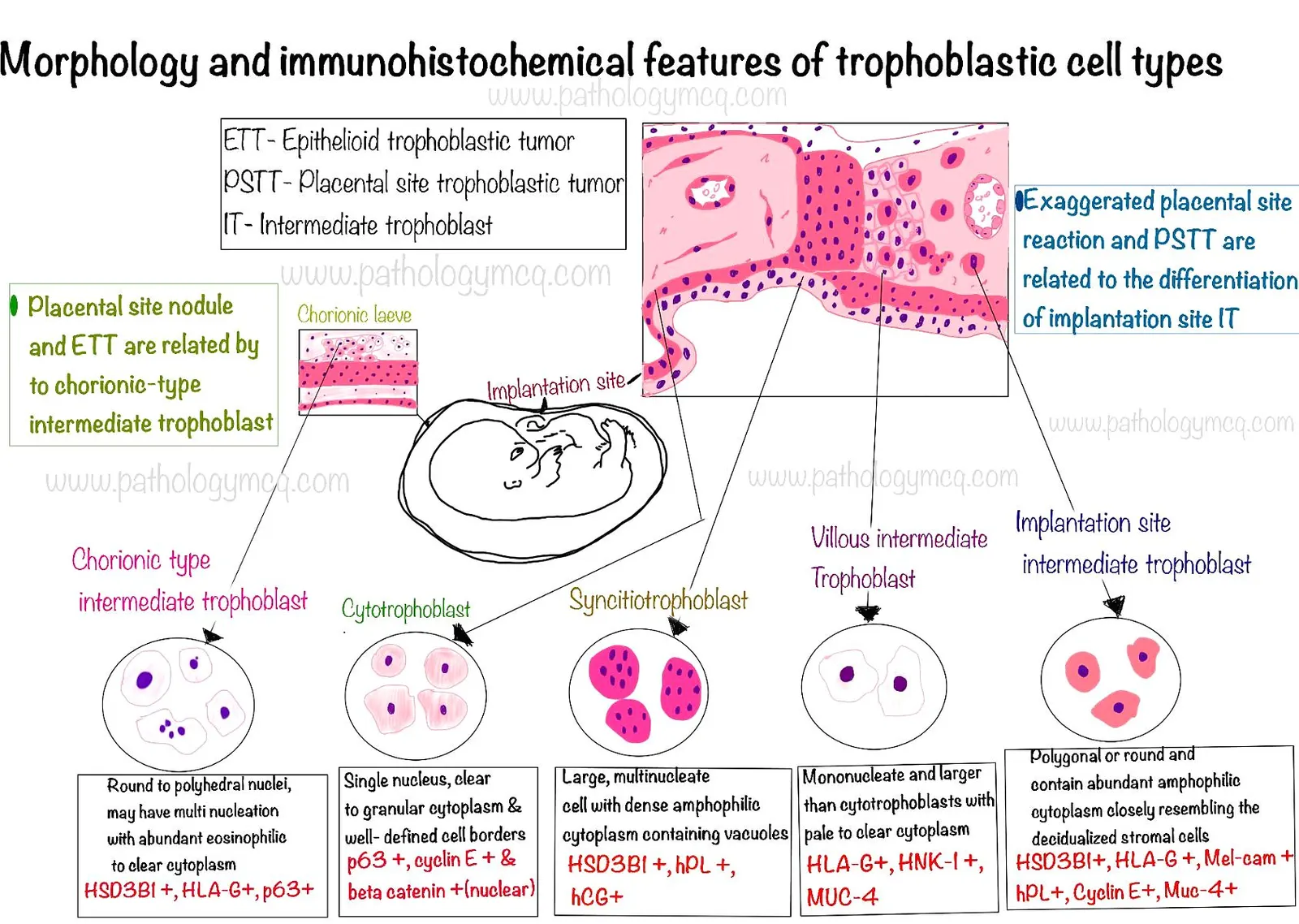 Morphology and Immunohistochemical features of trophoblastic cell types