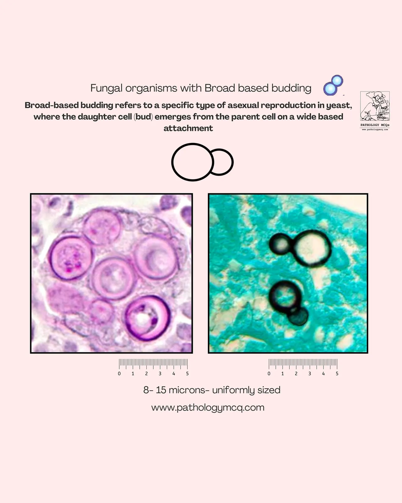Microscopic images showing fungal organisms with broad-based budding, illustrating the asexual reproduction process where daughter cells emerge from the parent cells. The image labels indicate the size of the cells (8-15 microns) and their uniformity.