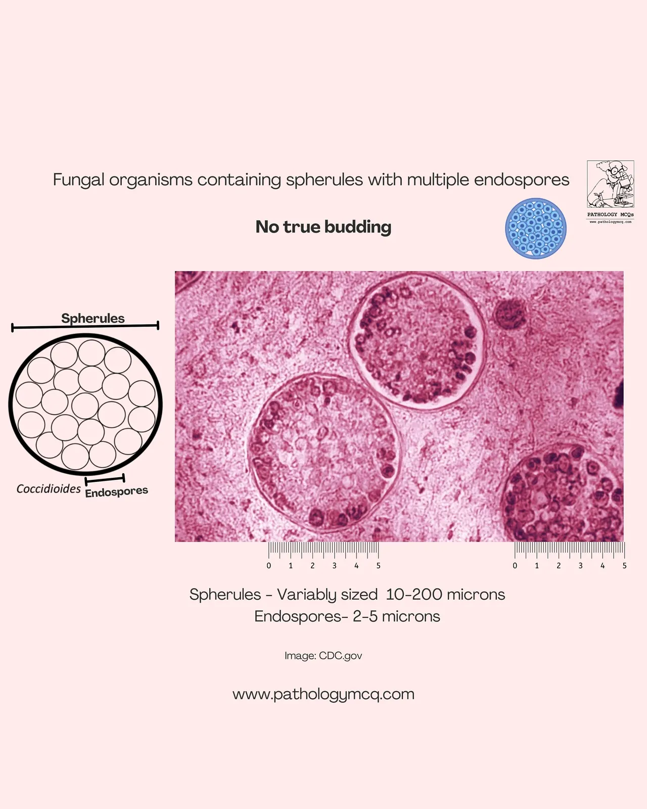 Microscopic view of fungal spherules containing multiple endospores, illustrating the size range of 10-200 microns for spherules and 2-5 microns for endospores, indicating no true budding.