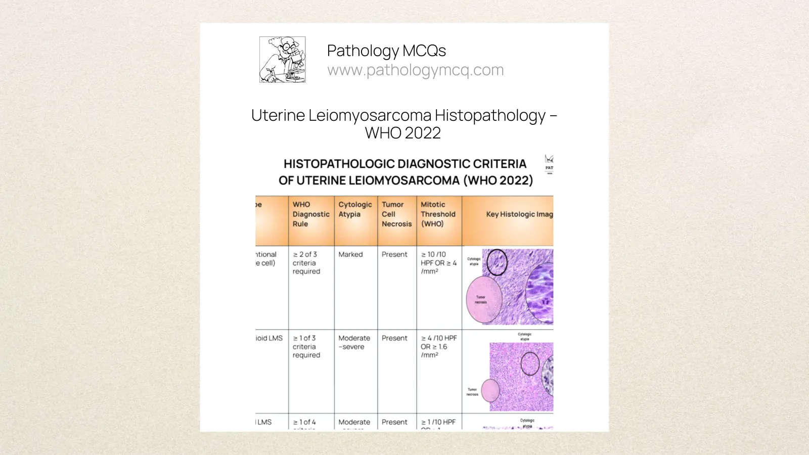 Uterine Leiomyosarcoma Histopathology – WHO 2022 Diagnostic Criteria, Subtypes and MCQs