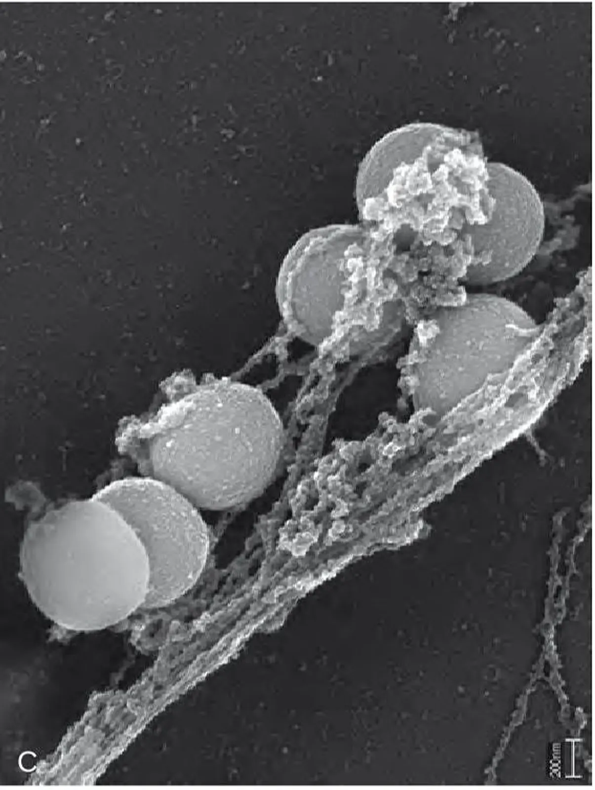 Significance of neutrophil extracellular traps (NETs)