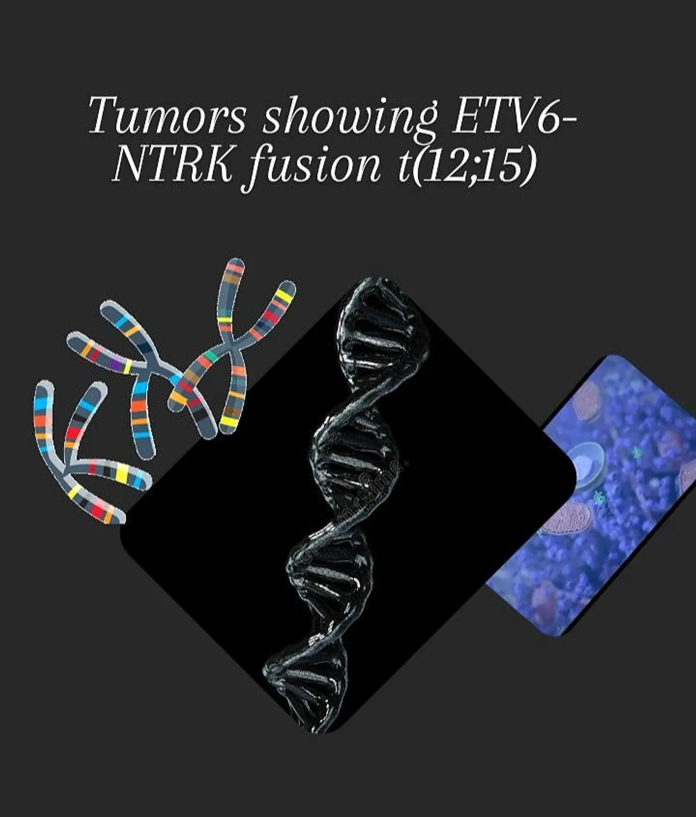 Tumors showing TRK (tropomyosin receptor kinase) gene fusion
