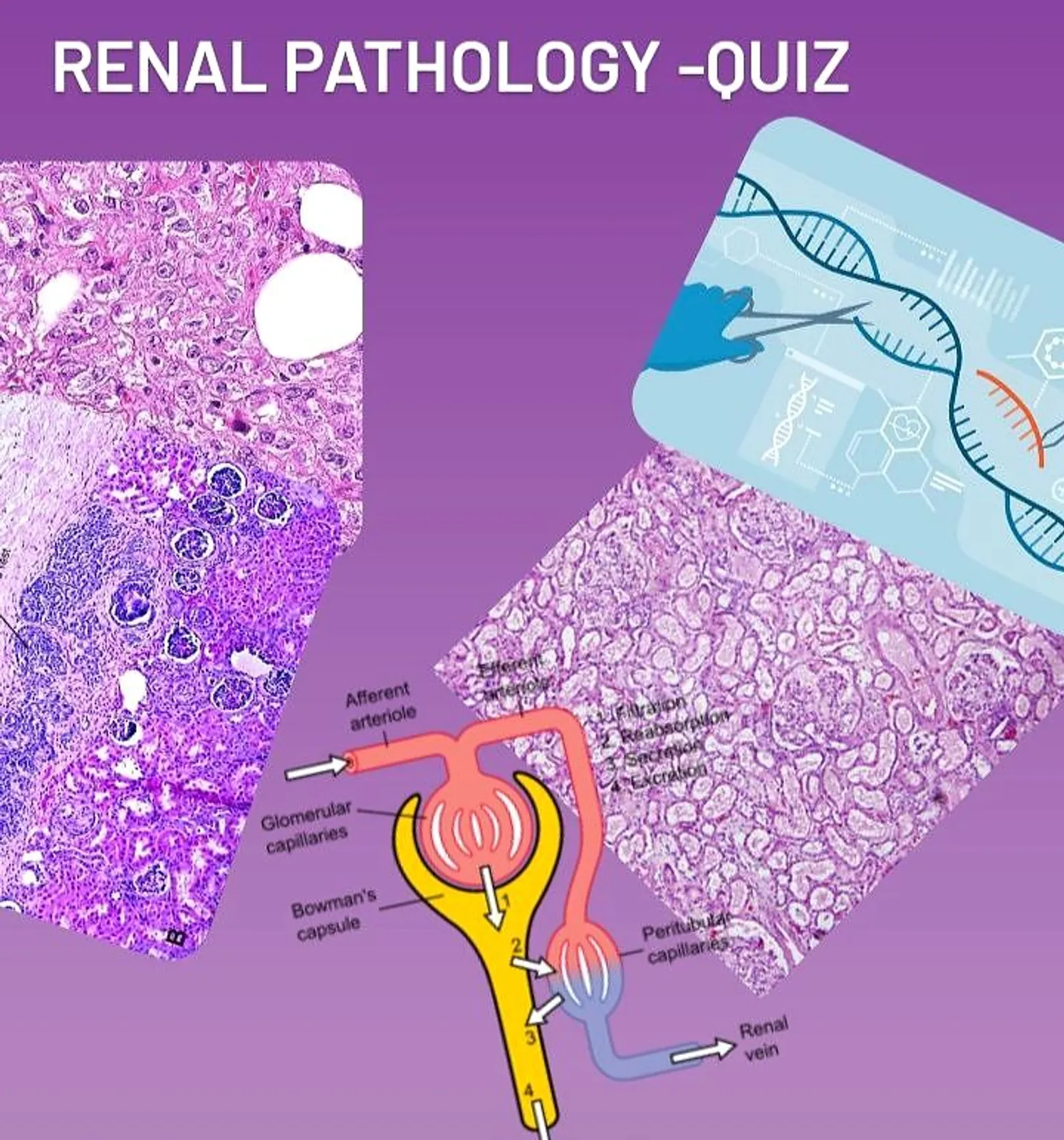 Renal pathology quiz