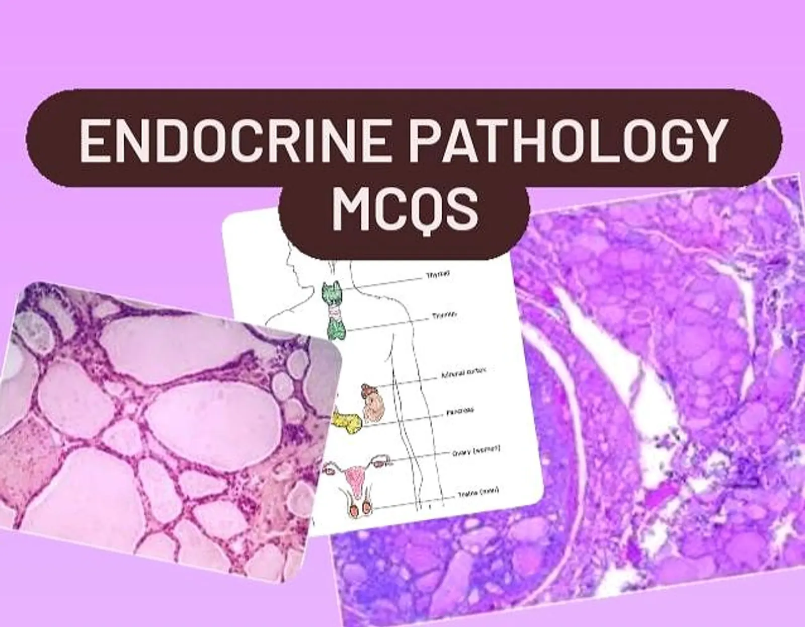 ENDOCRINE PATHOLOGY QUIZ