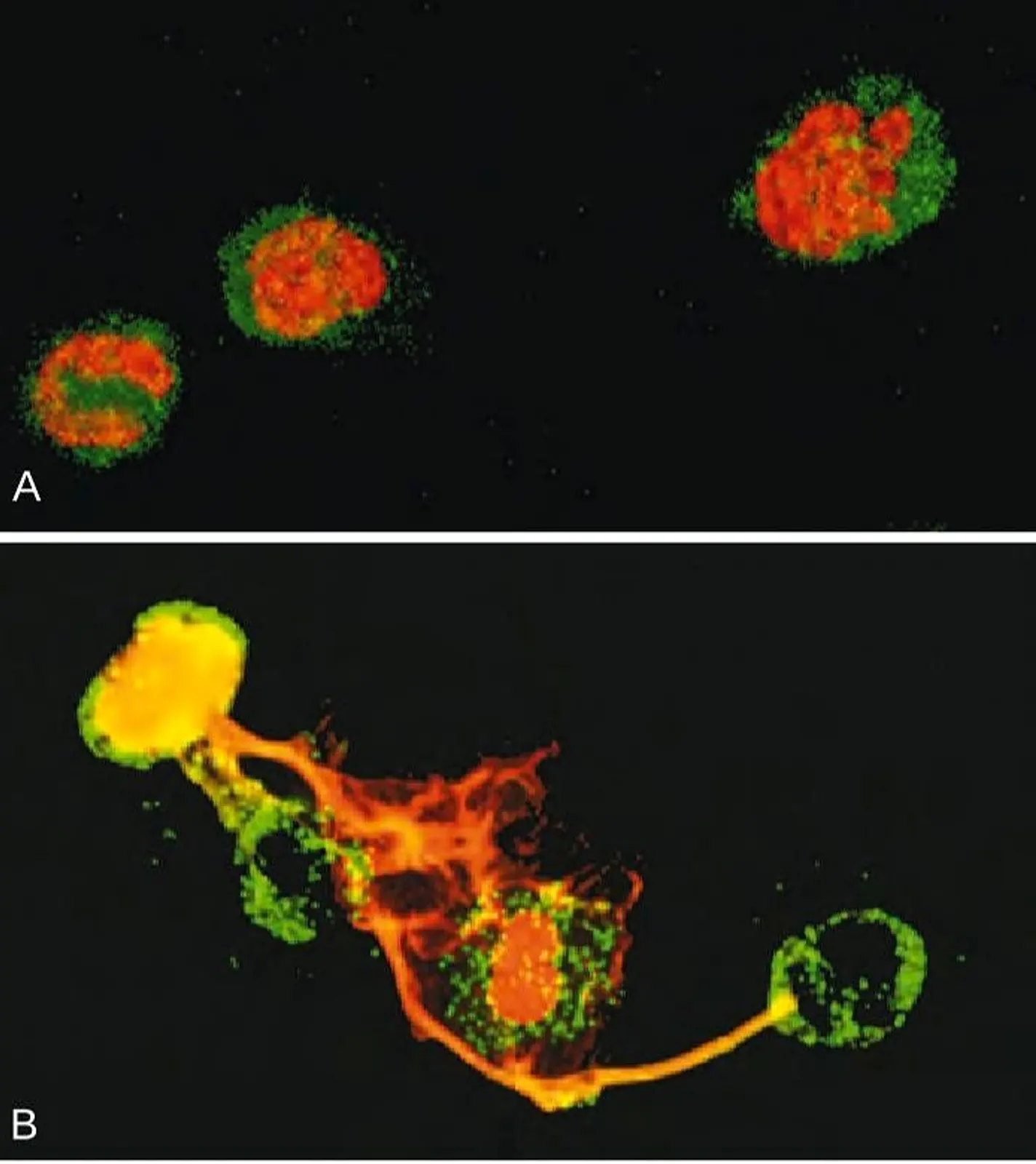 Significance of neutrophil extracellular traps (NETs)