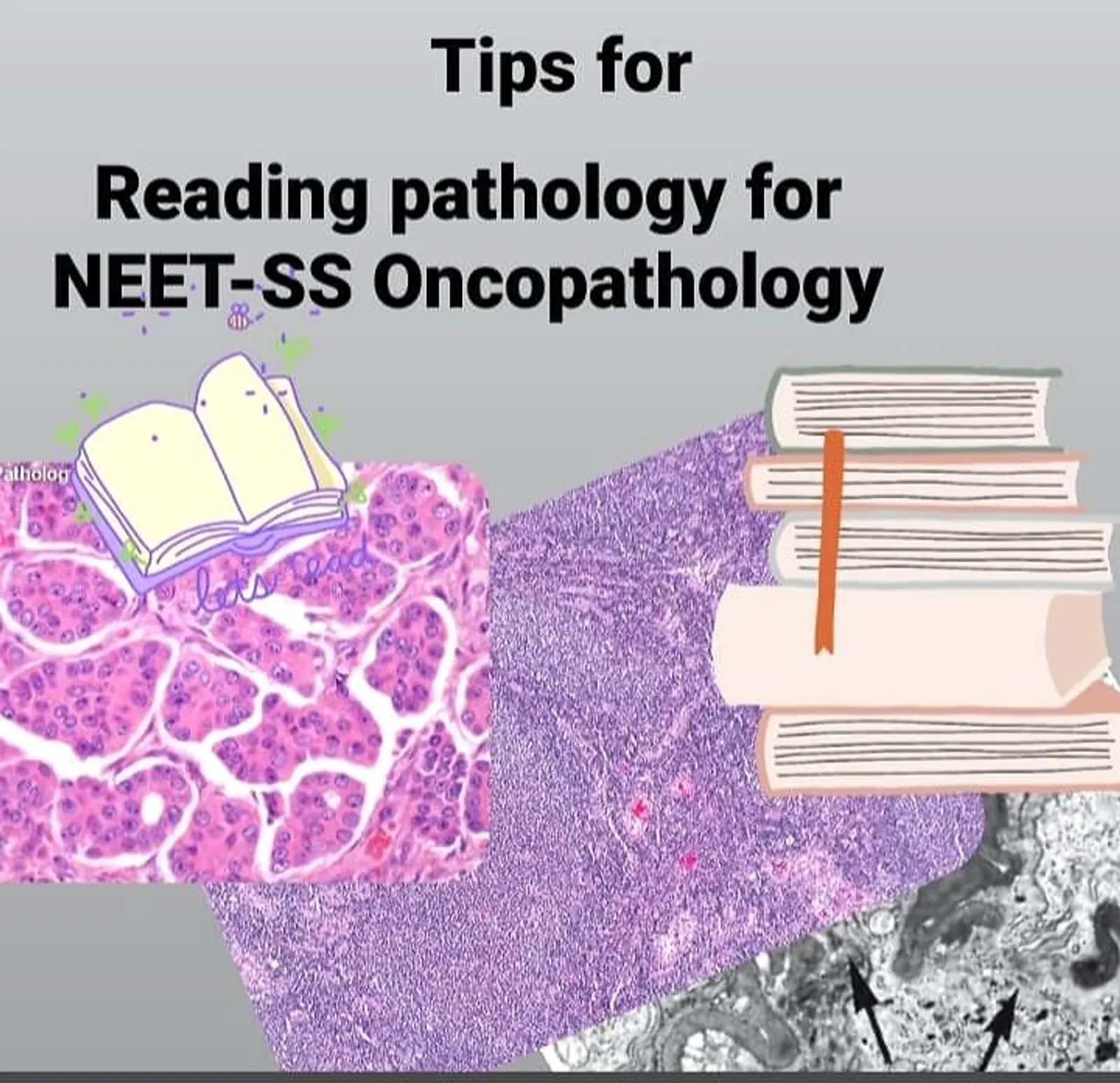 Tips to study for NEET-SS Oncopathology