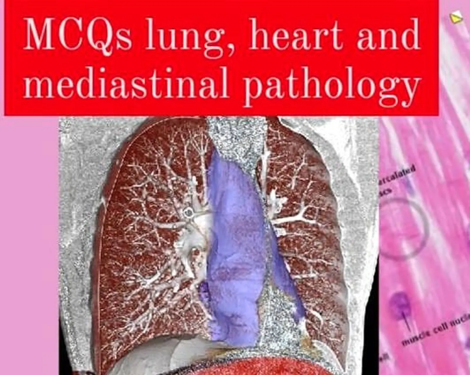 LUNG, HEART AND MEDIASTINAL PATHOLOGY QUIZ