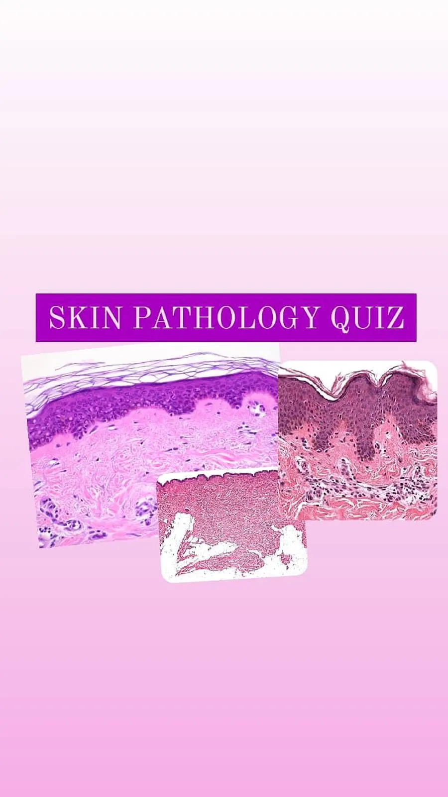 SKIN PATHOLOGY QUIZ