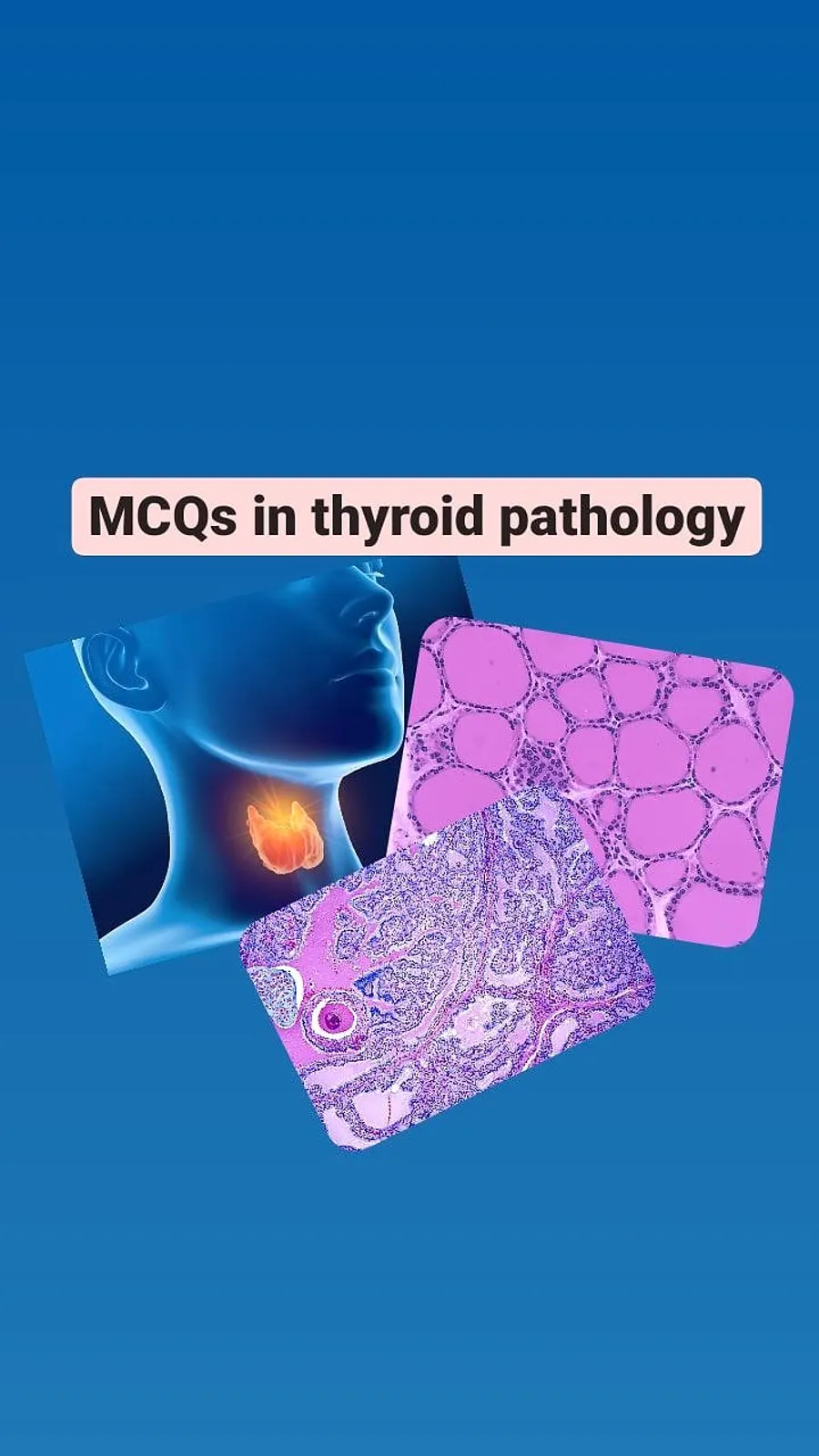 THYROID PATHOLOGY QUIZ