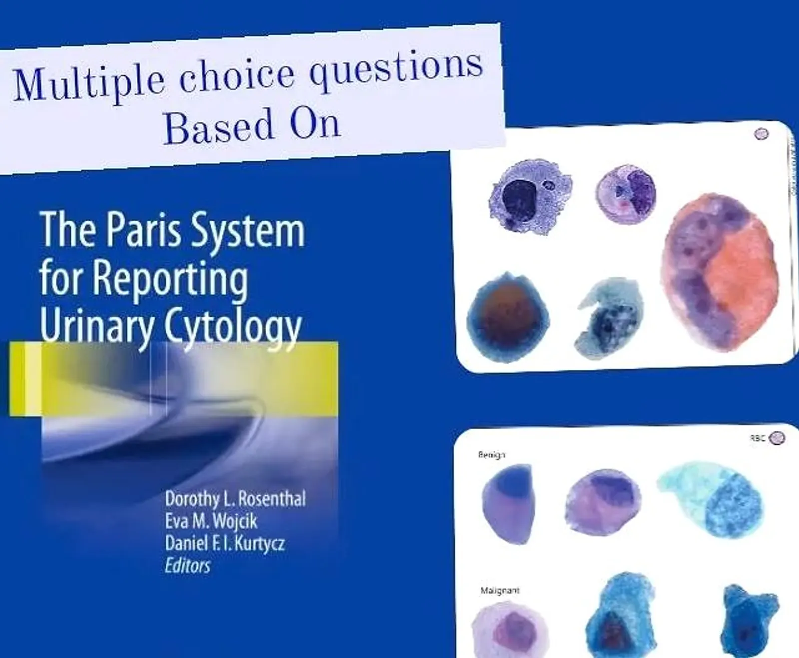 PARIS SYSTEM FOR REPORTING URINARY CYTOLOGY MCQs