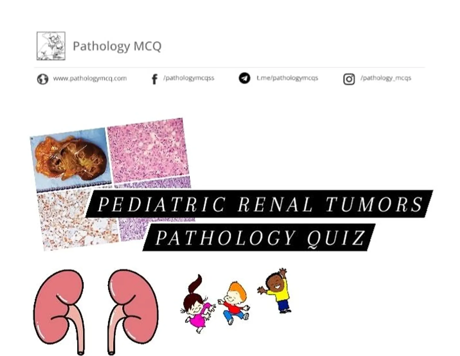 PEDIATRIC RENAL  TUMORS QUIZ