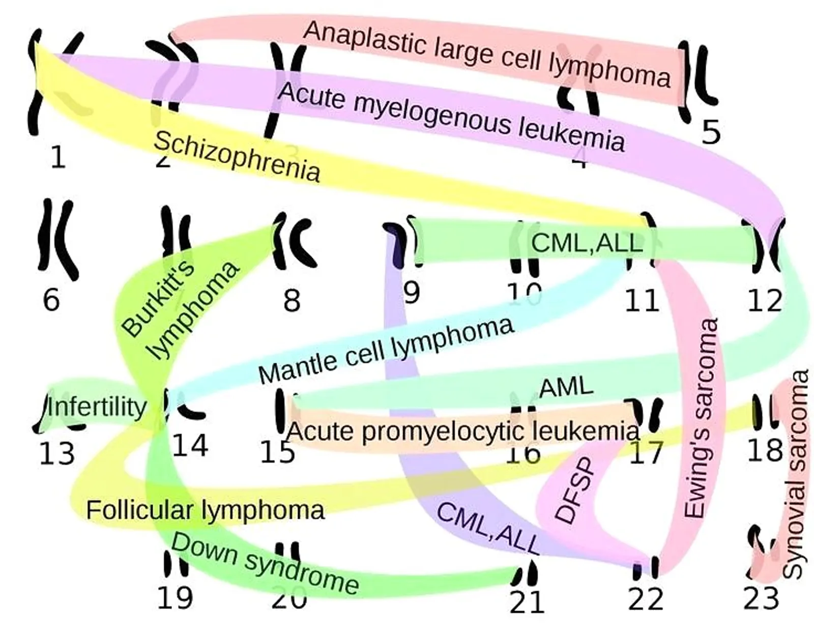 IMPORTANT TRANSLOCATIONS IN LYMPHOMAS AND LEUKEMIAS