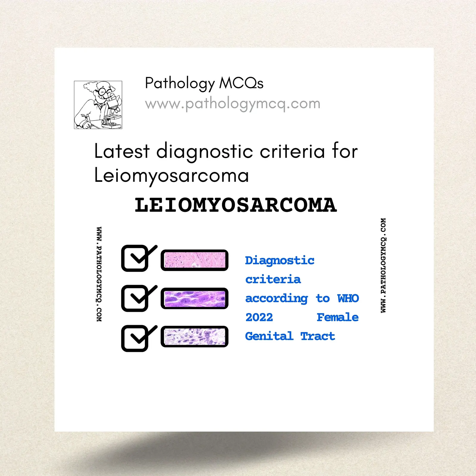 Leiomyosarcoma diagnostic criteria