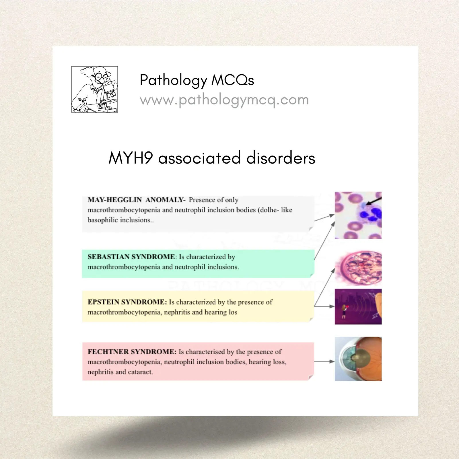 MYH-9 associated congenital macrothrombocytopenias