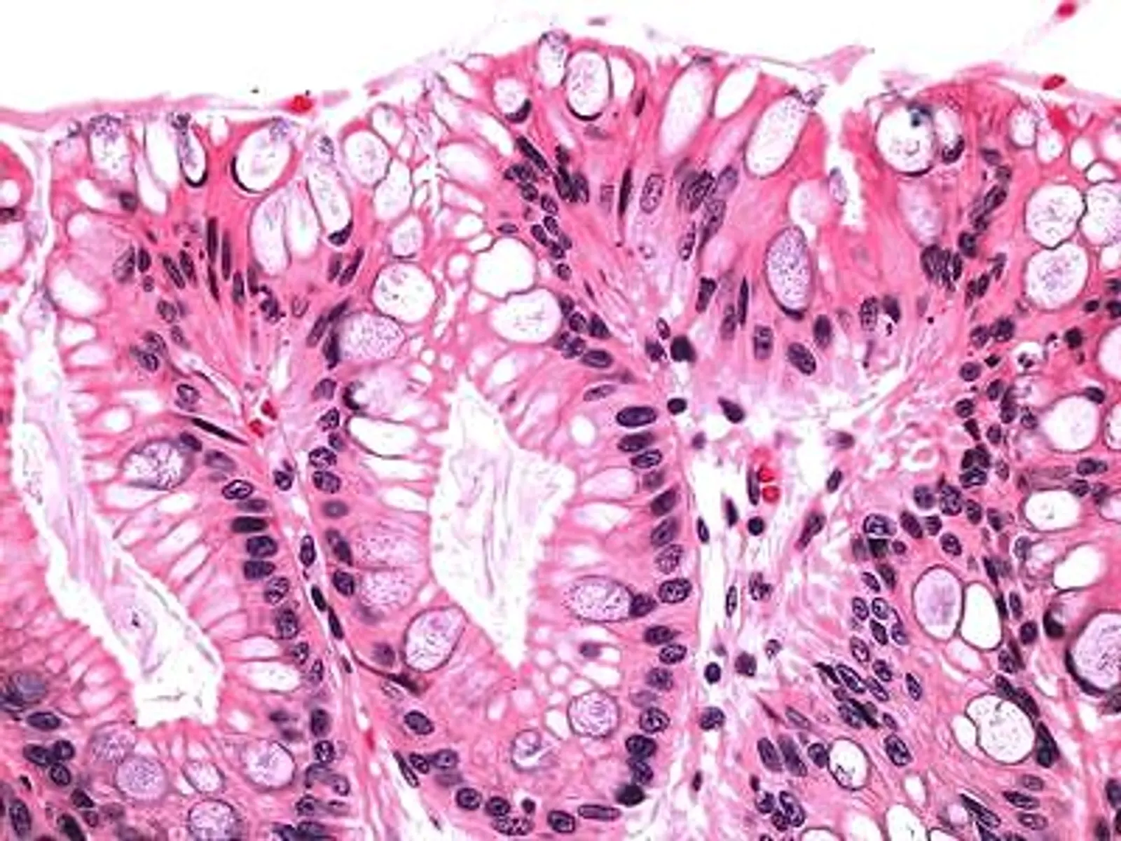 Batter esophagus showing goblet cells