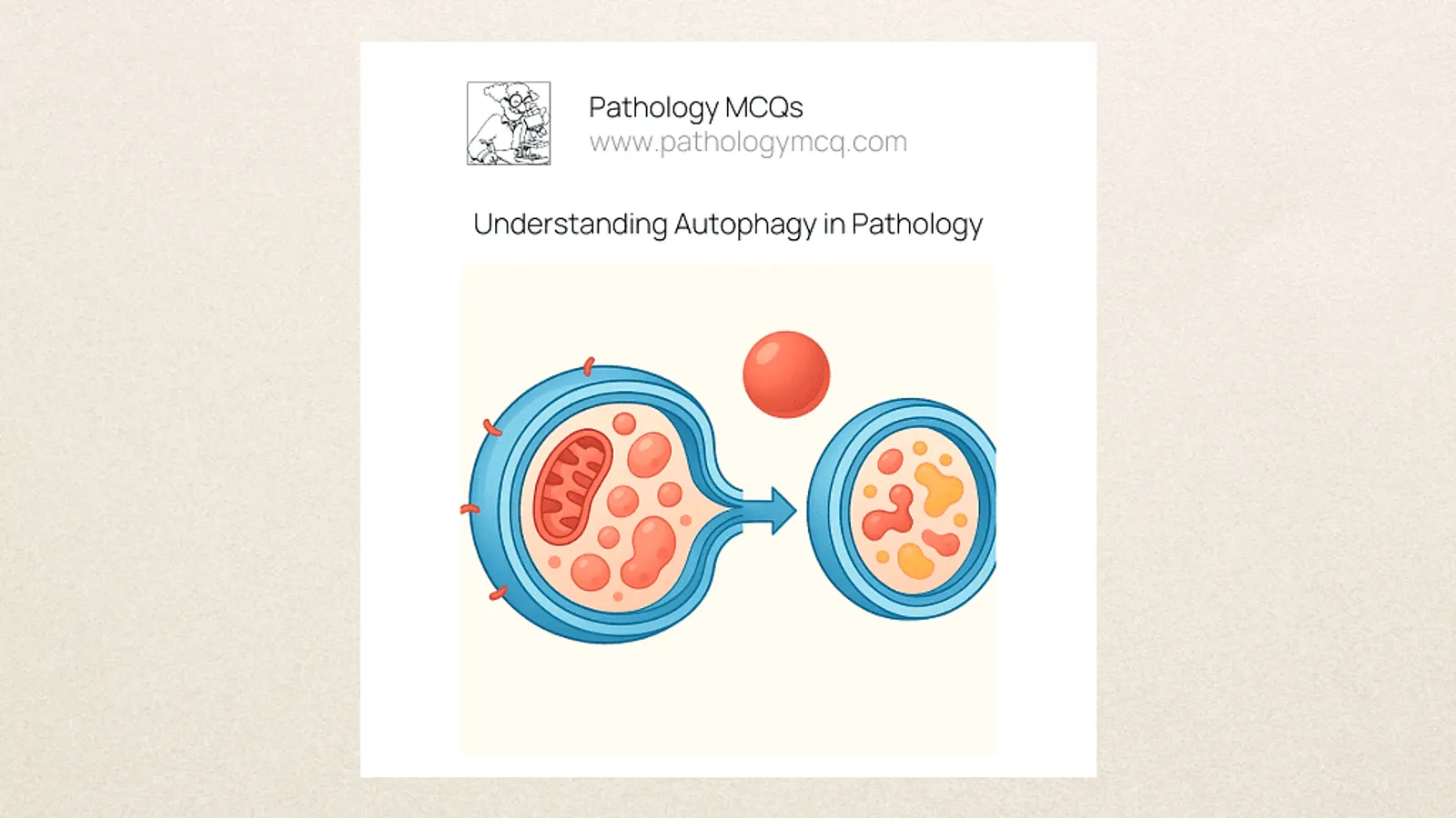 “Medical illustration of cellular autophagy showing autophagosome formation, double-membrane structure, LC3-II expression, and fusion with lysosome for cytoplasmic degradation.”