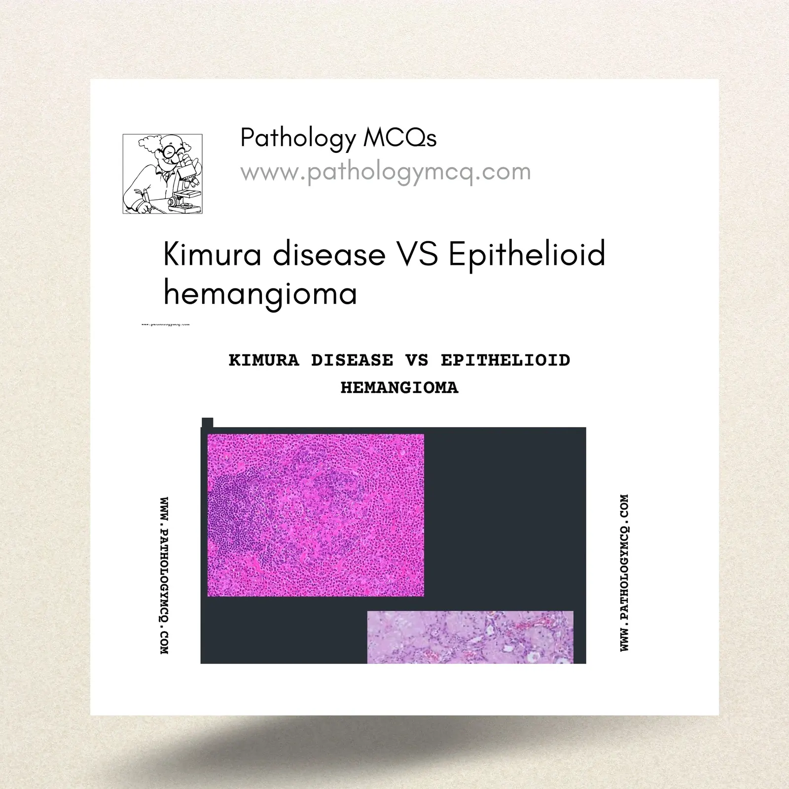 Kimura Disease vs Epithelioid Hemangioma: Key Differences