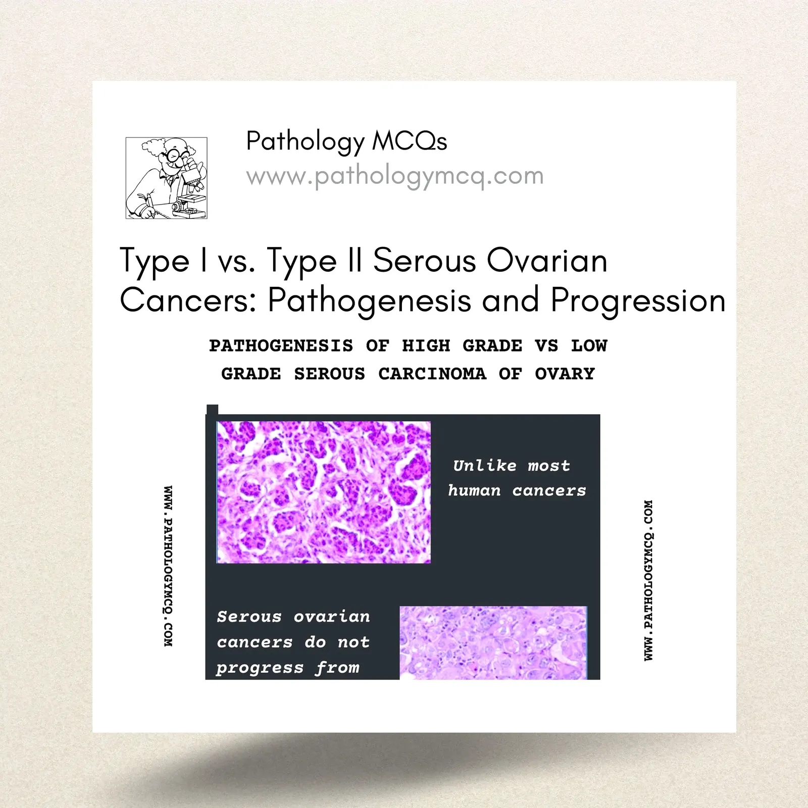 Type I vs. Type II Serous Ovarian Cancers: Pathogenesis and Progression