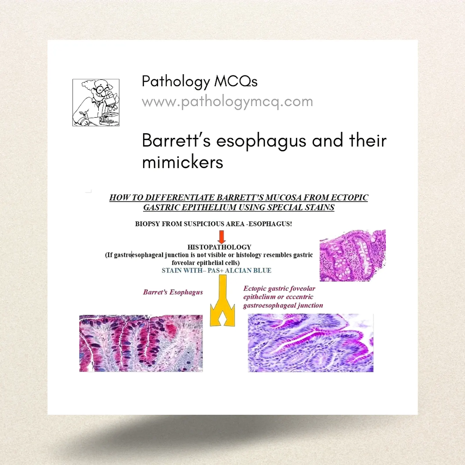 Barrett’s Esophagus and their mimickers