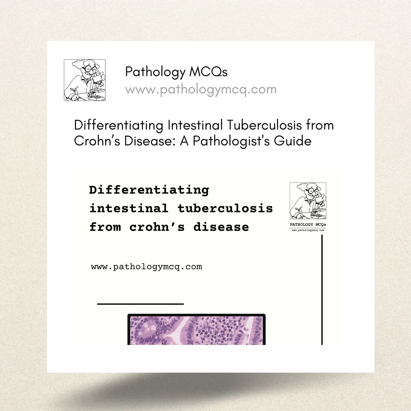Differentiating Intestinal Tuberculosis from Crohn’s Disease: A Pathologist's Guide