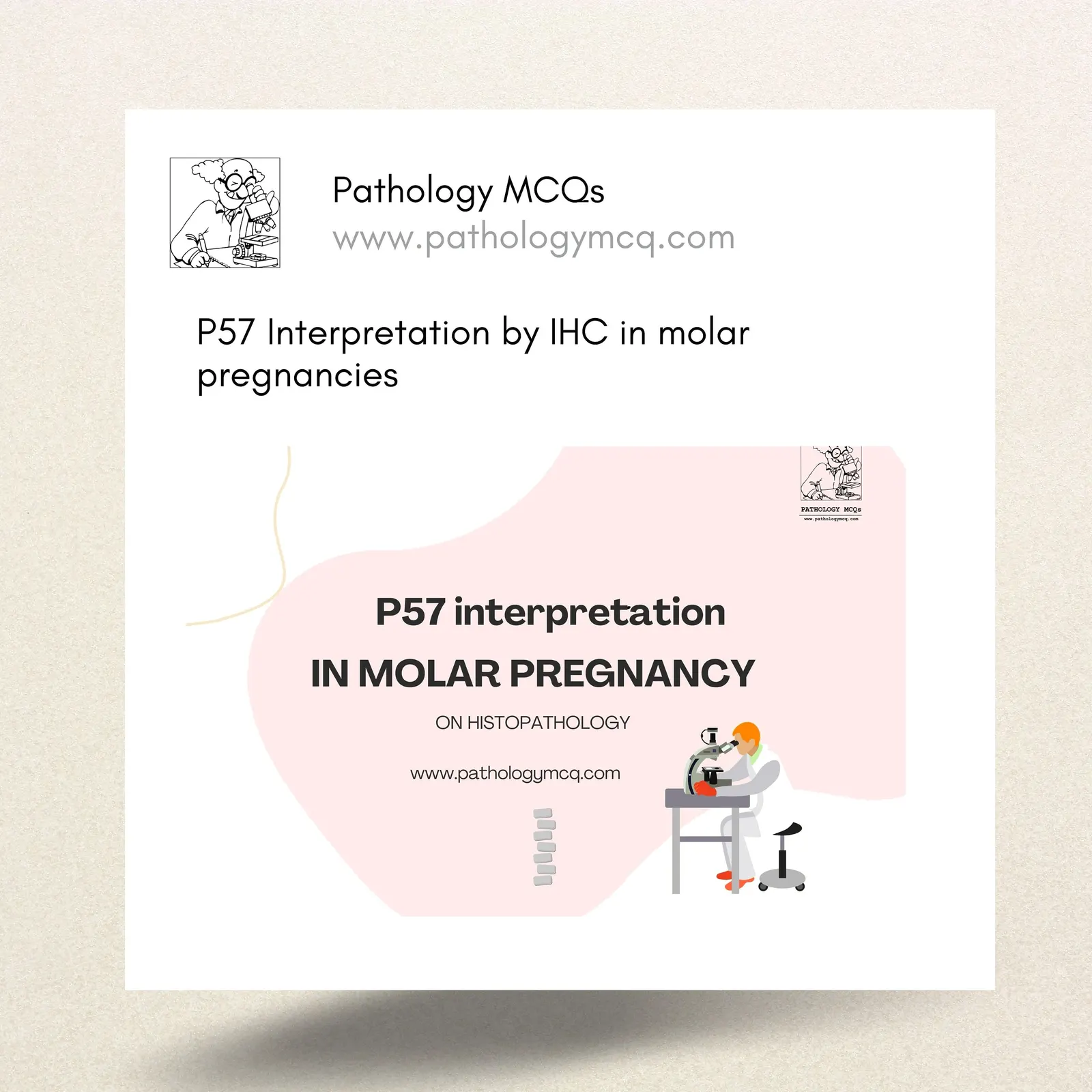 Understanding p57 in Molar Pregnancy: Histopathology and Diagnostic Role