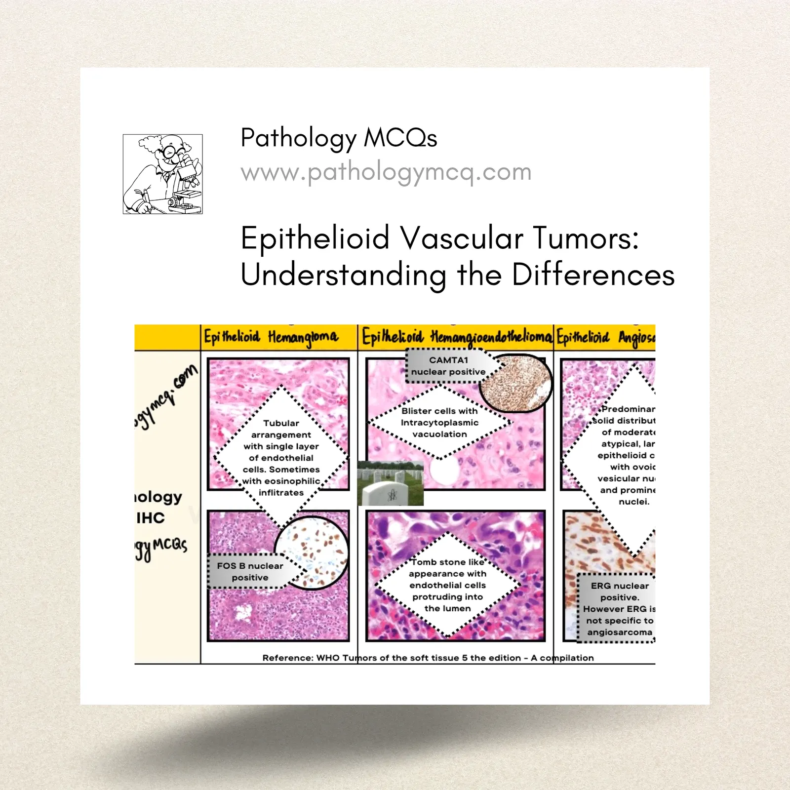 Epithelioid Vascular Tumors: Understanding the Differences