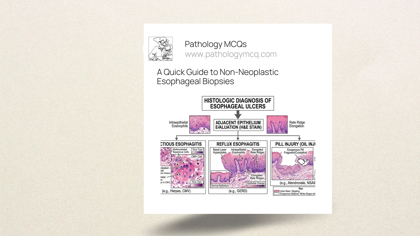 A Quick Guide to Non-Neoplastic Esophageal Biopsies