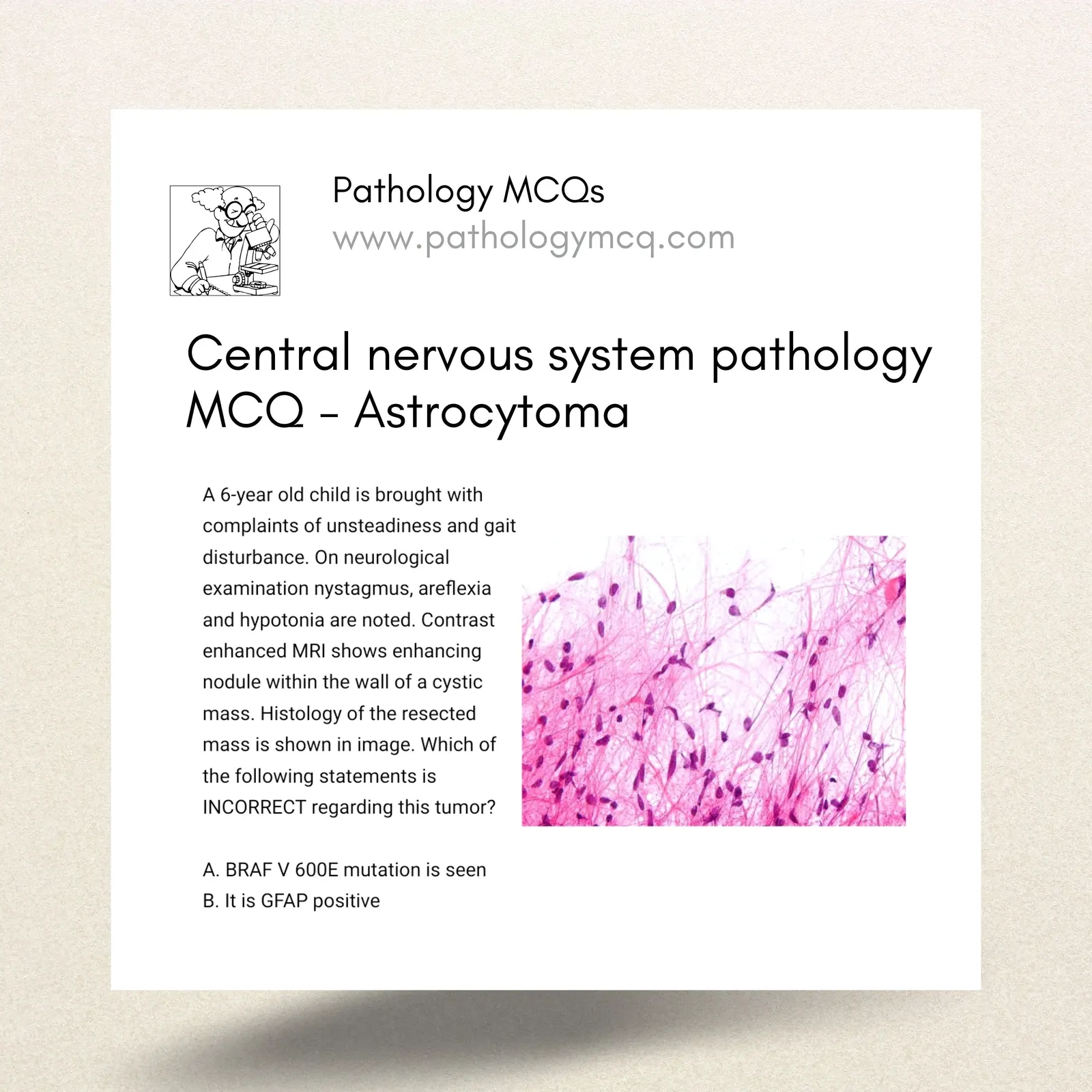 Central nervous system pathology MCQ - Astrocytoma