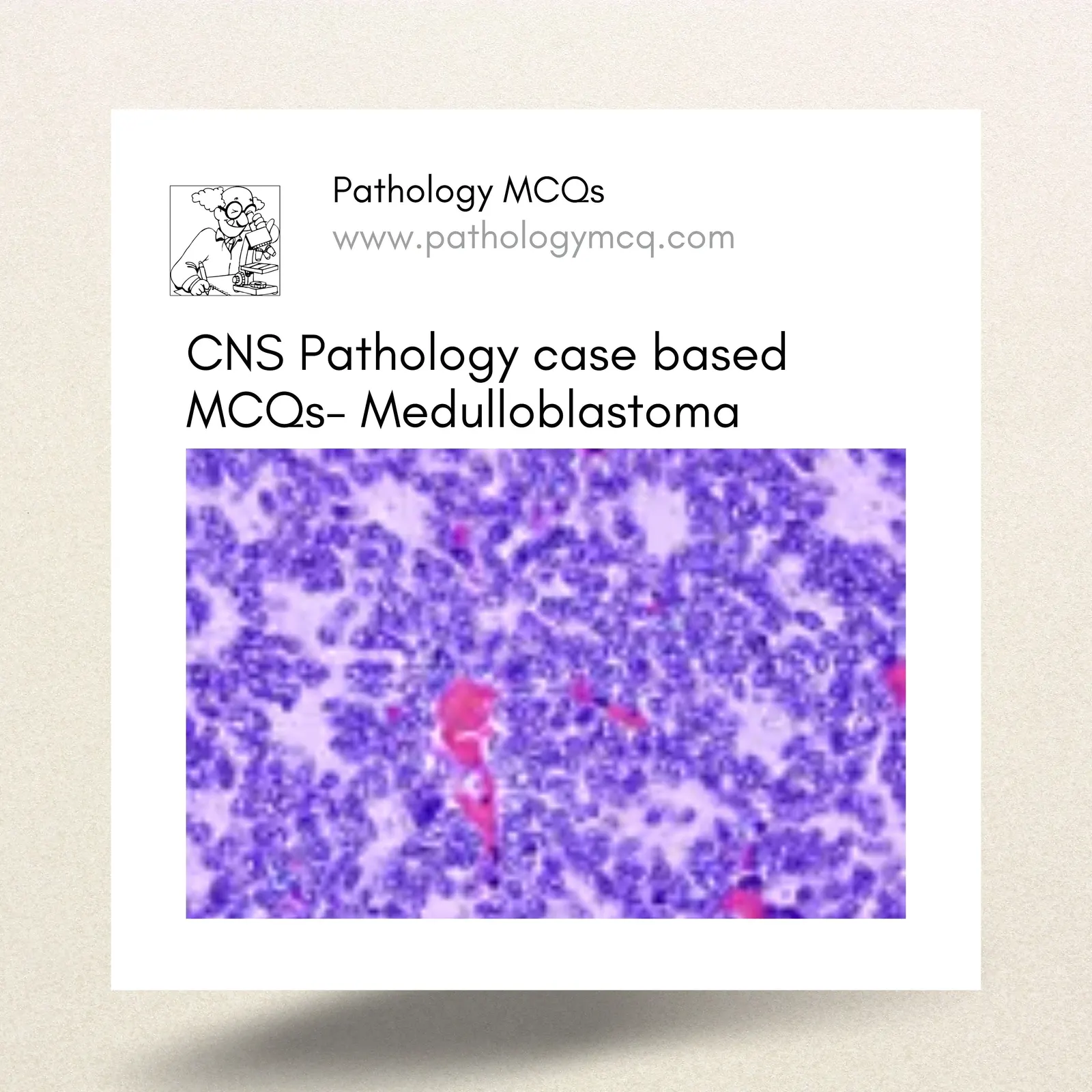 CNS Pathology case based MCQs- Medulloblastoma
