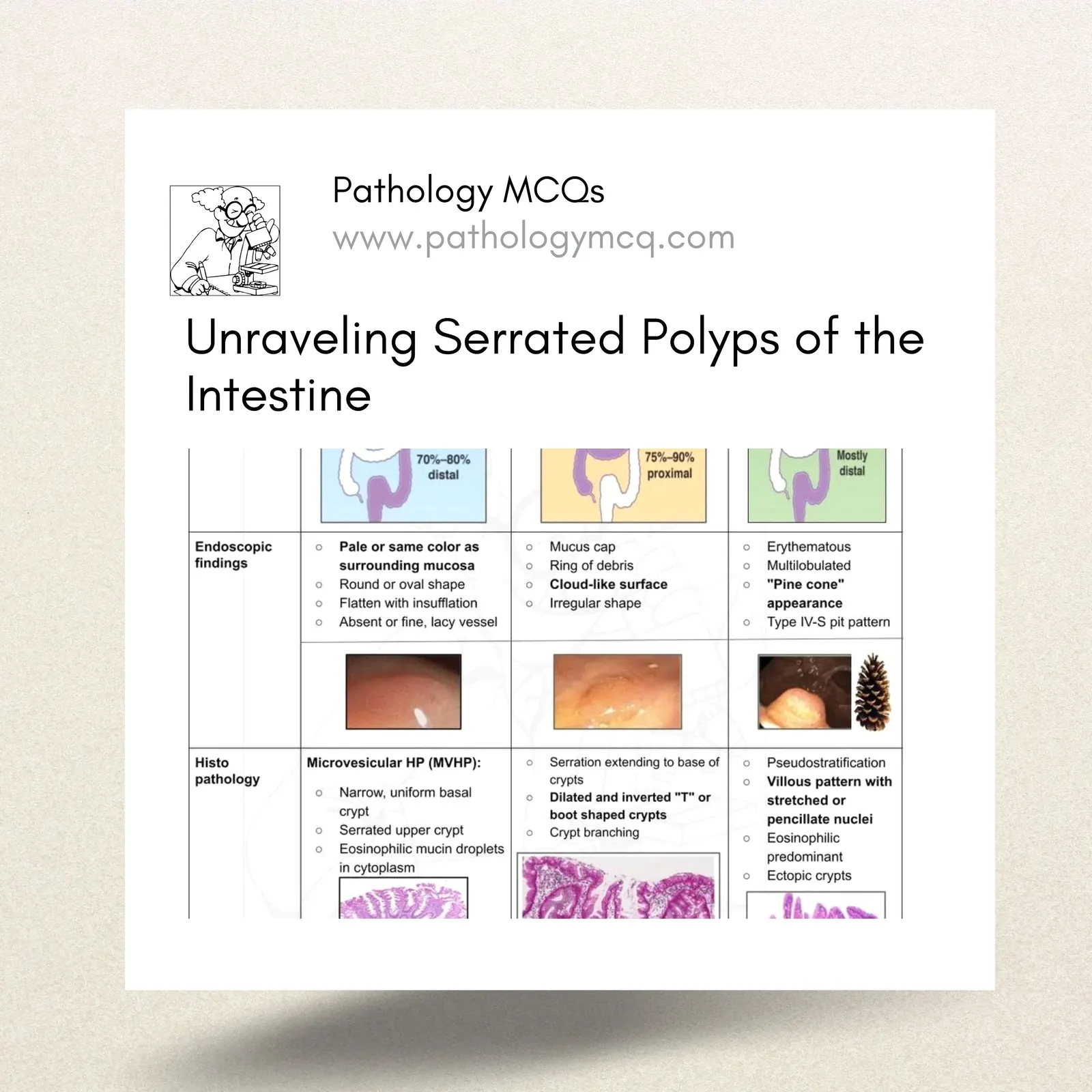 Unraveling Serrated Polyps of the Intestine: A Comprehensive Guide