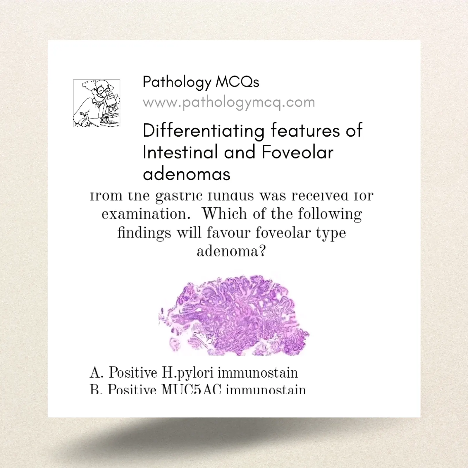 Navigating the Microscopic Maze: Differentiating Intestinal and Foveolar Adenomas in Histopathology