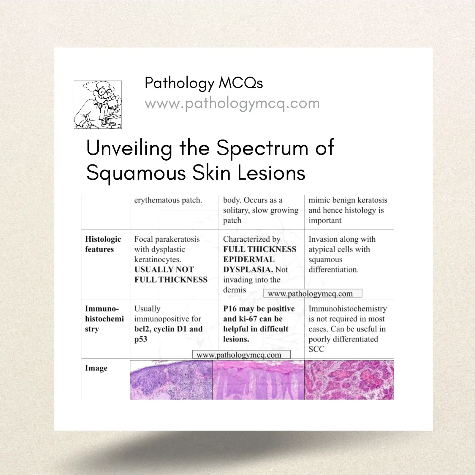 Actinic Keratosis, Bowen's Disease, and Squamous Cell Carcinoma: A Histological Journey