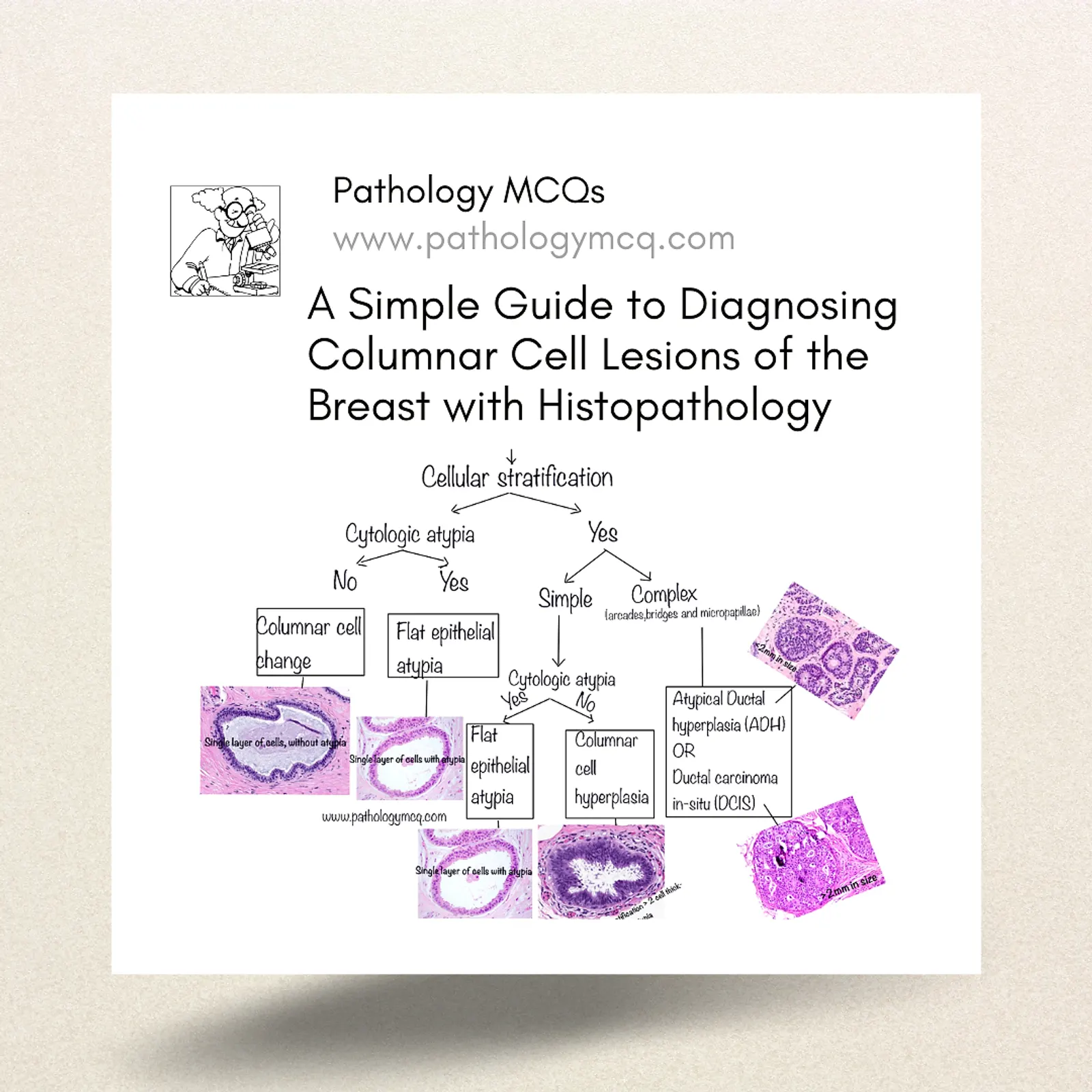 A Simple Guide to Diagnosing Columnar Cell Lesions of the Breast with Histopathology
