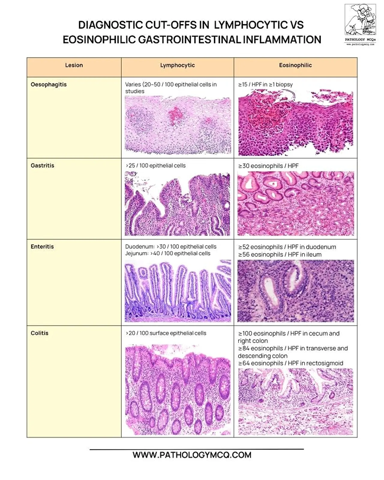 A chart comparing diagnostic cut-offs for lymphocytic versus eosinophilic gastrointestinal inflammation, featuring lesions such as oesophagitis, gastritis, enteritis, and colitis, with criteria and histological images for each category.