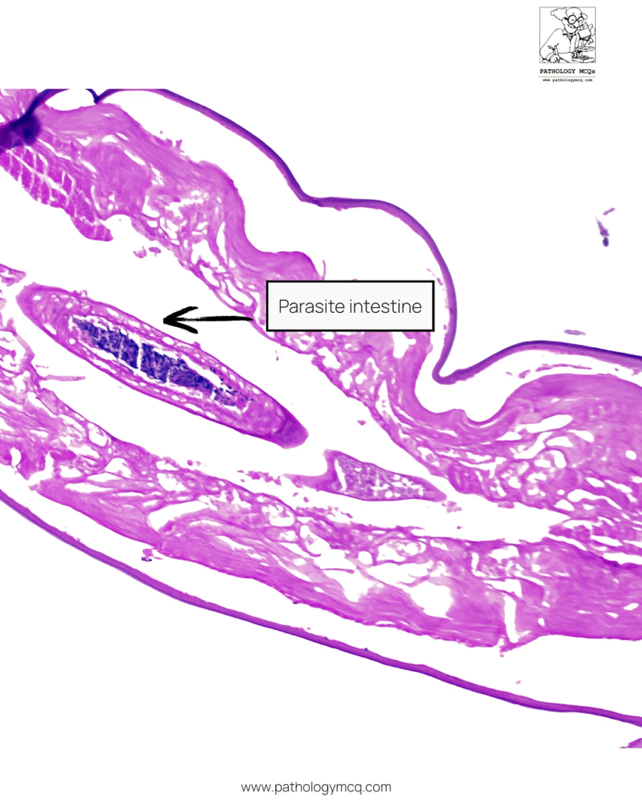 Histologic section showing central intestinal lumen of Dirofilaria repens