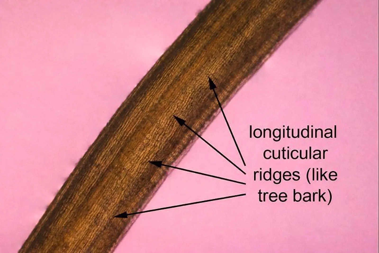 Histologic cross section of Dirofilaria repens showing characteristic longitudinal cuticular ridges