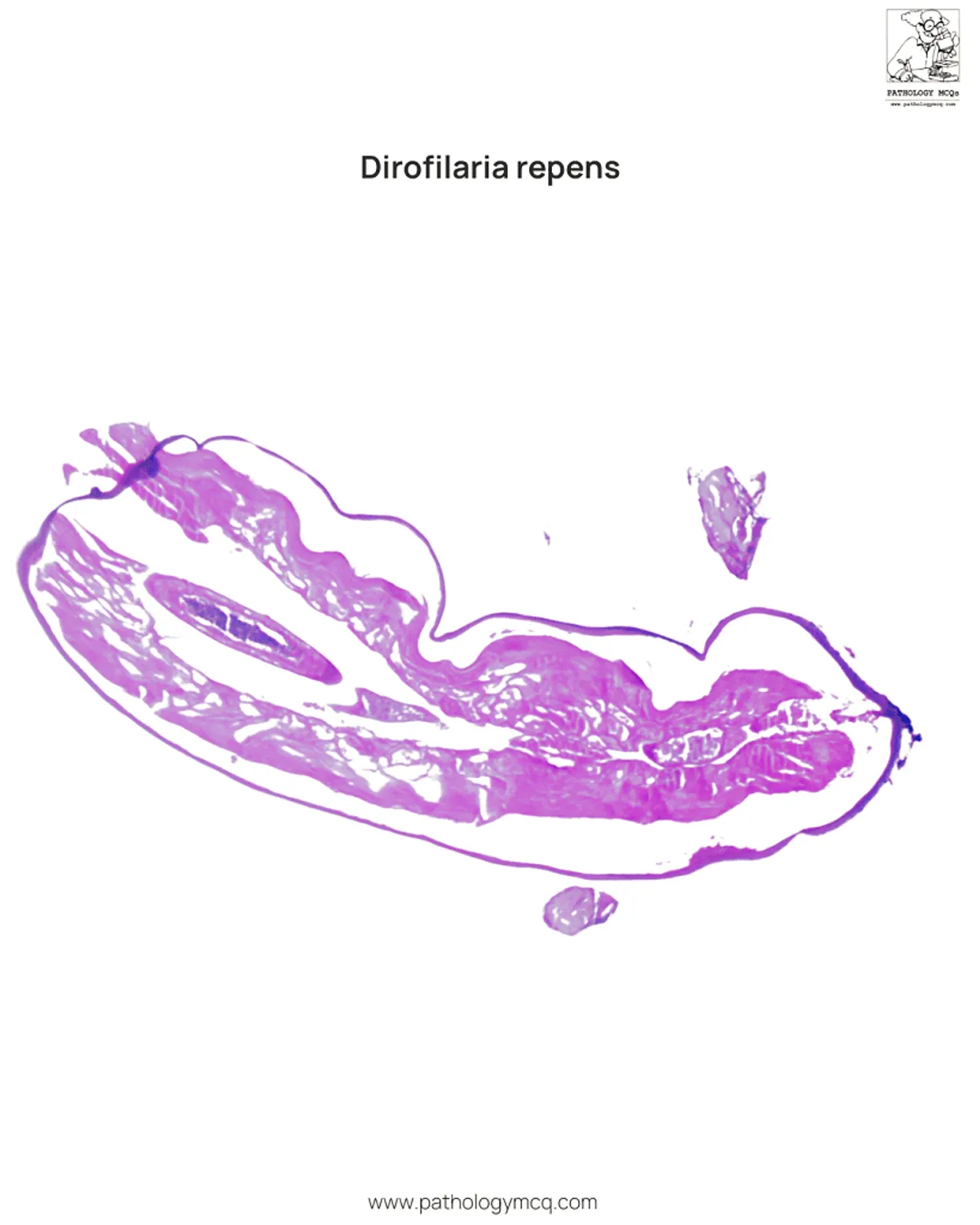 Cross-section of Dirofilaria repens showing prominent muscular layer