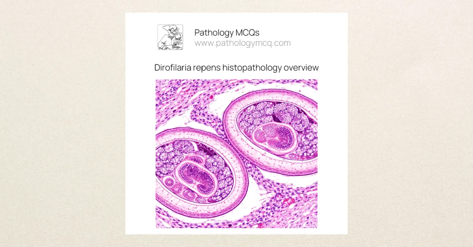 Histopathology of Dirofilaria repens showing nematode structure within tissue
