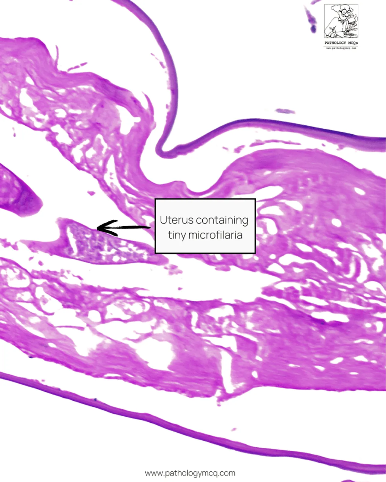 Female Dirofilaria repens showing uterus filled with microfilariae