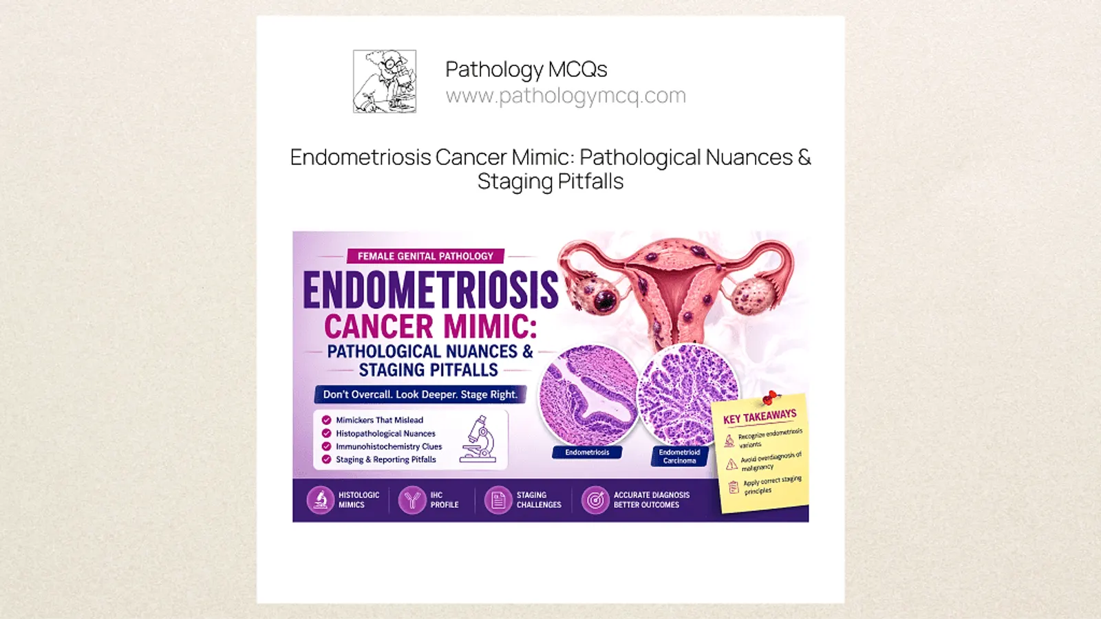 Infographic on endometriosis as a cancer mimic, detailing pathological nuances and staging pitfalls, featuring illustrations of female reproductive anatomy and histological images.