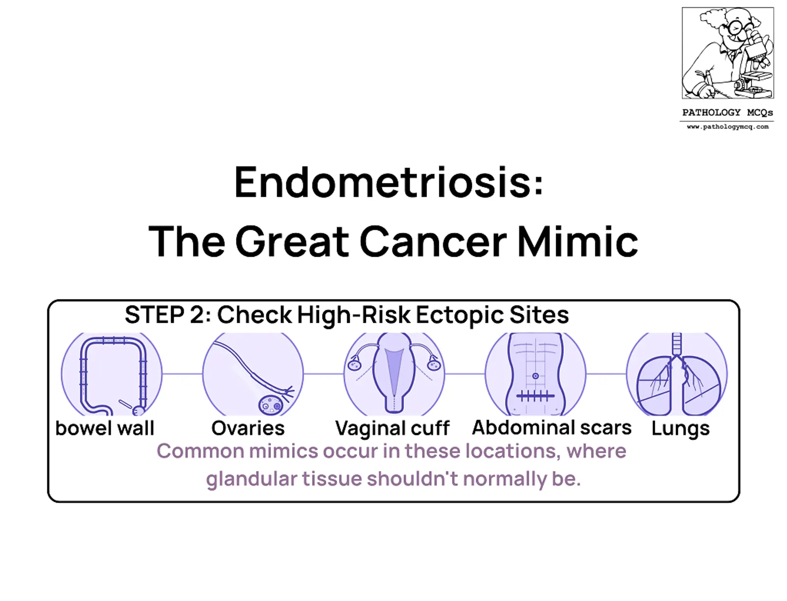 Illustration titled 'Endometriosis: The Great Cancer Mimic' with a step highlighting high-risk ectopic sites, including bowel wall, ovaries, vaginal cuff, abdominal scars, and lungs, accompanied by a note about common mimics occurring in these locations.