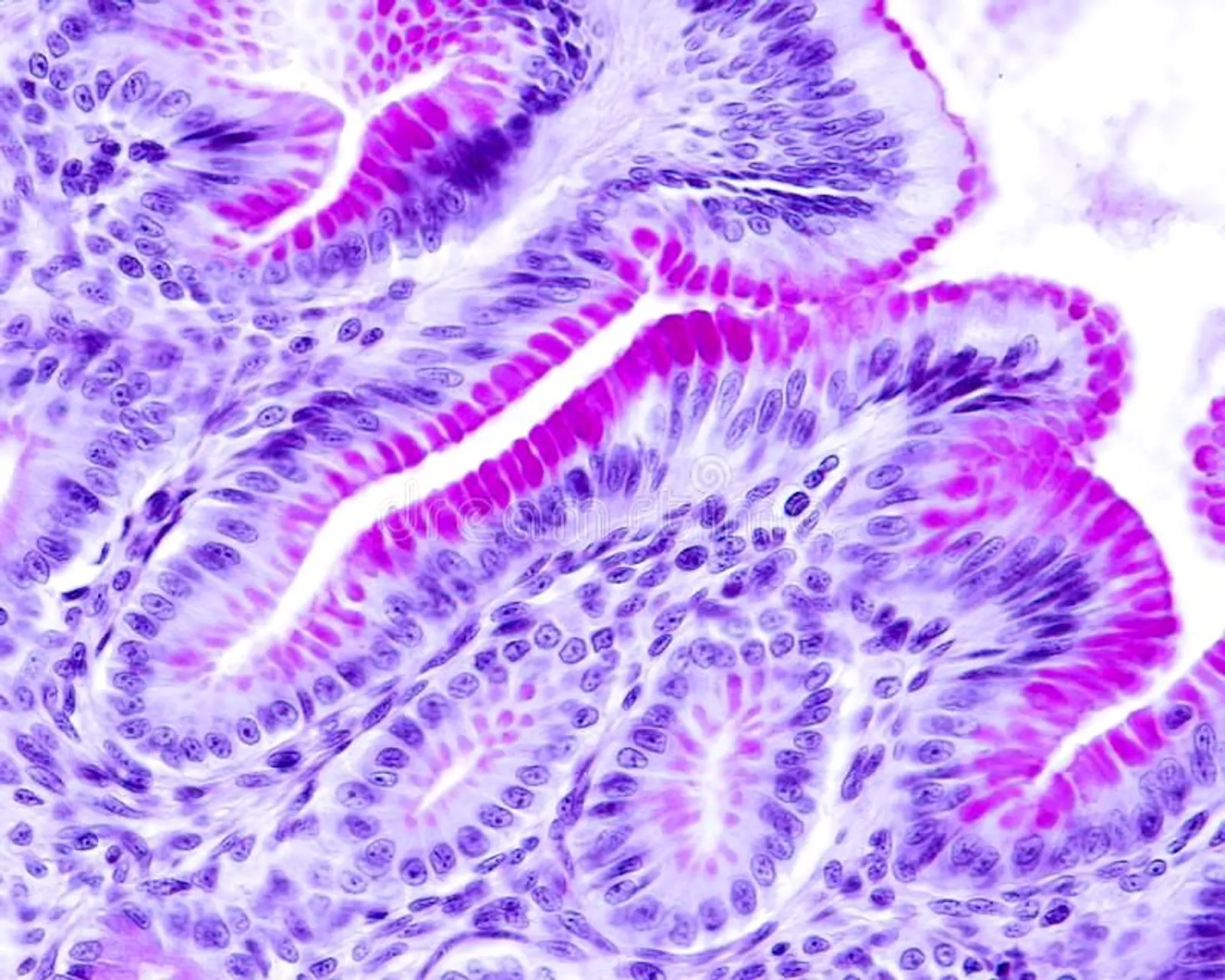 carbohydrate staining- PAS stained gastric foveolar cells