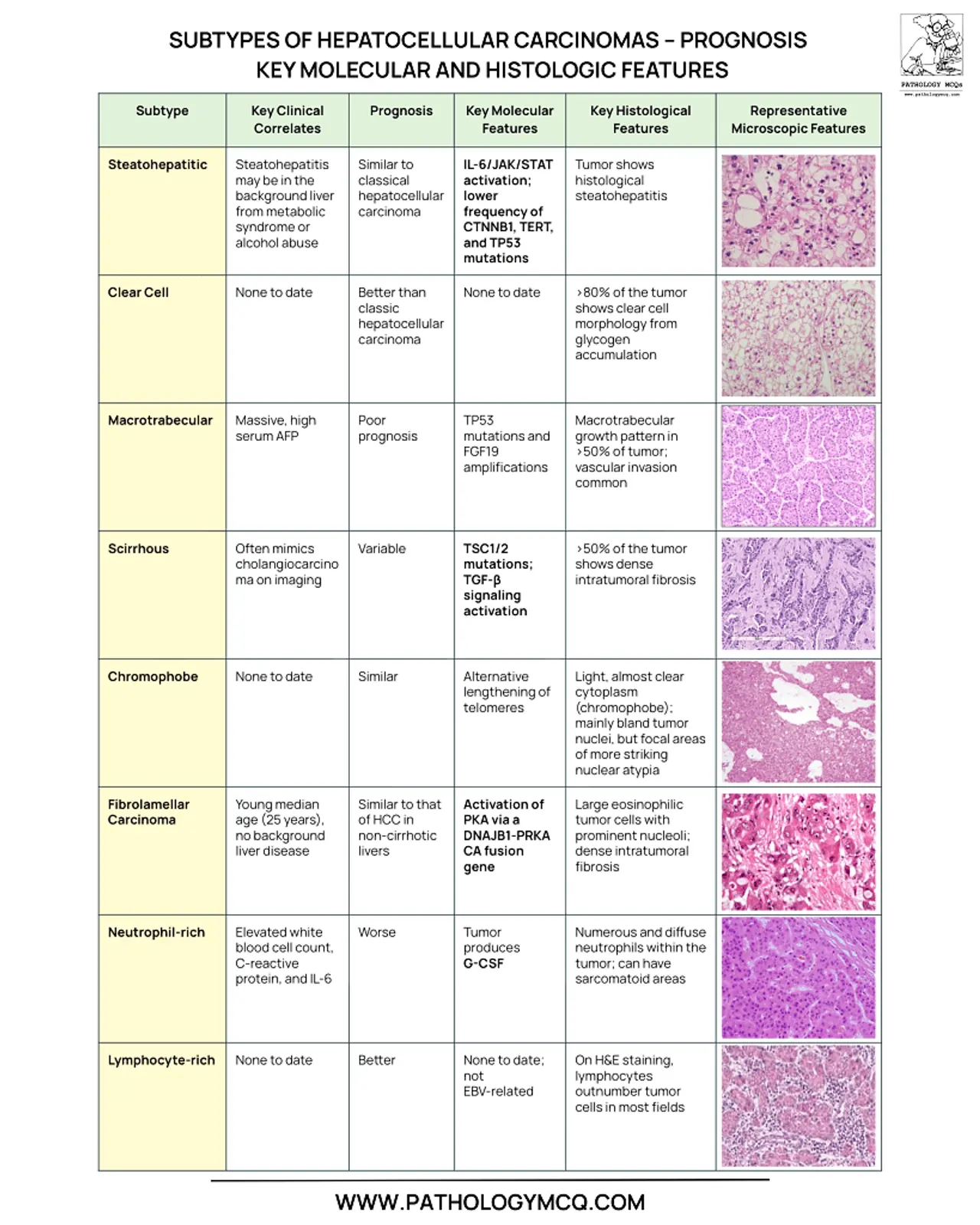 Detailed table of hepatocellular carcinoma subtypes showing clinical (e.g., steatohepatitic freq 6-36%), prognosis (e.g., MTM poor), molecular (e.g., DNAJB1-PRKACA), and microscopic features (e.g., thick trabeculae).