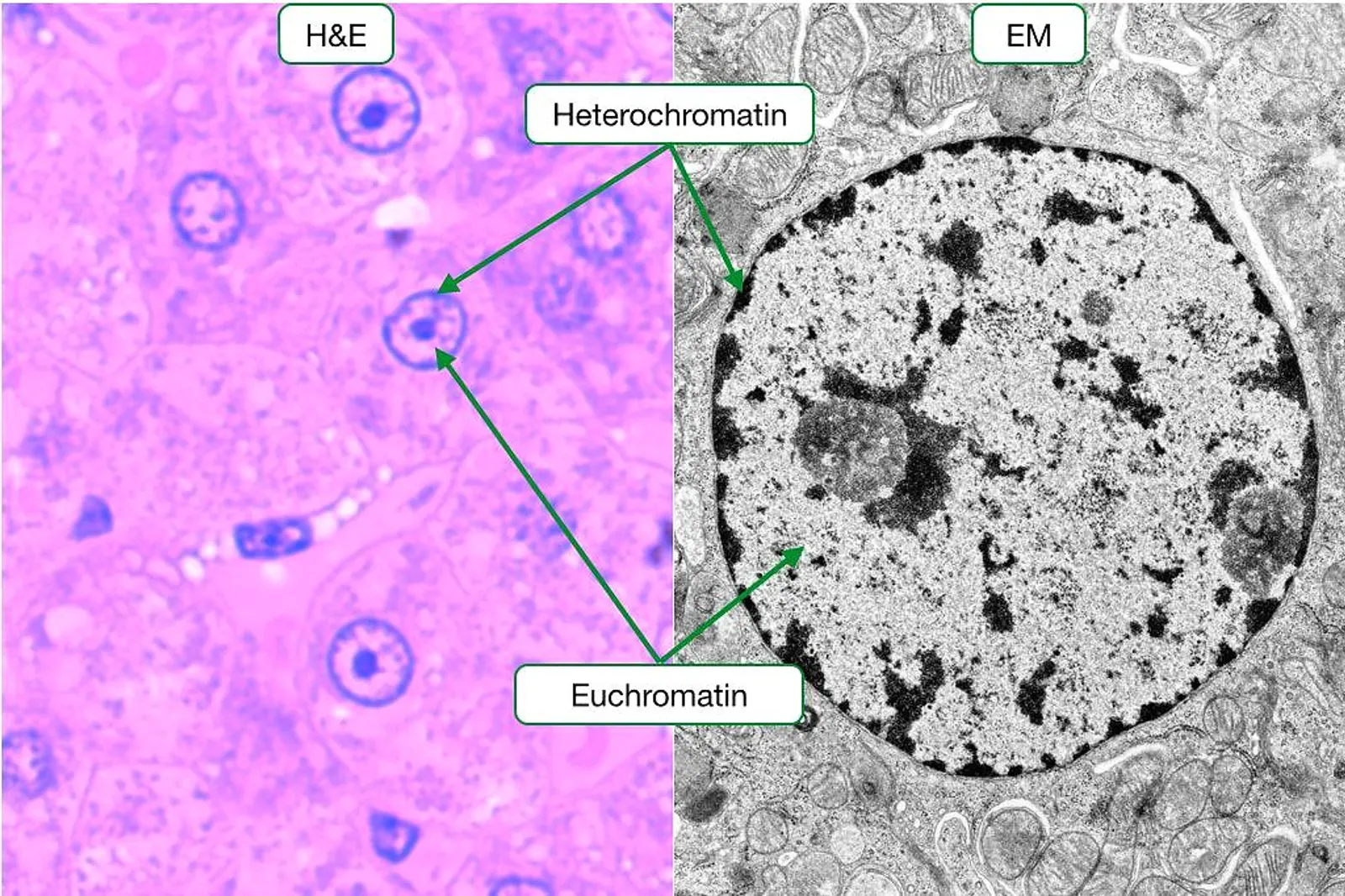 Side-by-side comparison of H&E stained tissue and electron microscopy showing heterochromatin and euchromatin in the nucleus