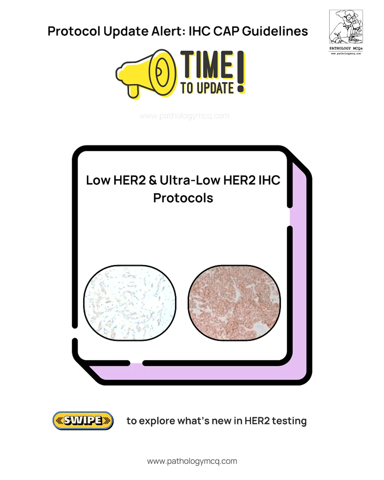 IHC CAP 2025 guideline update visual announcing Low and Ultra-Low HER2 protocol changes