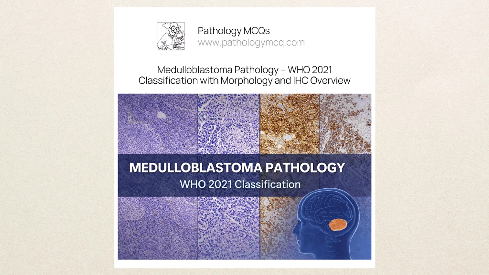 Medulloblastoma pathology overview illustrating morphology, immunohistochemistry markers and WHO 2021 molecular classification of cerebellar tumor