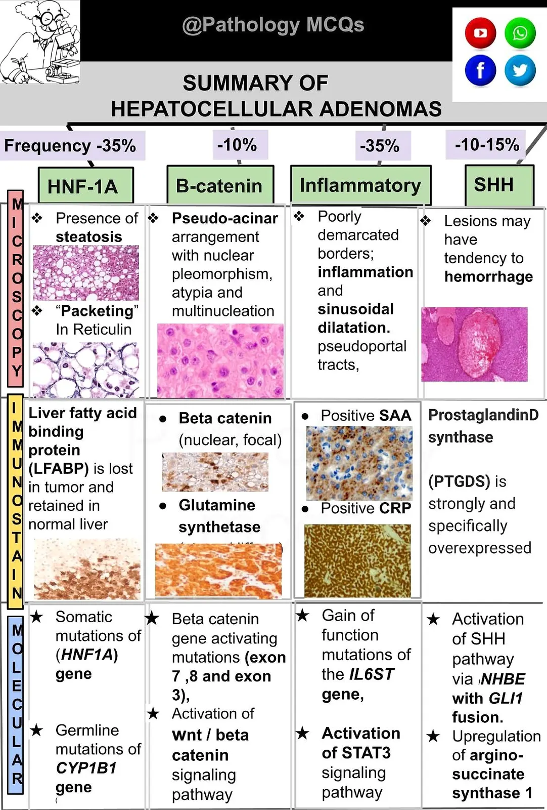 Multiple choice questions hepatocellular adenomas.