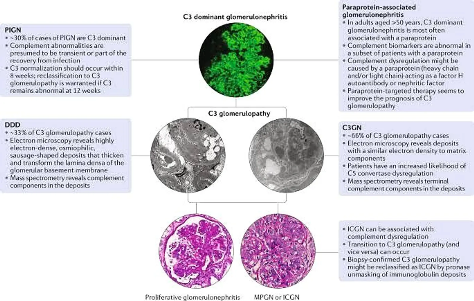 C3 Glomerulopathy- A new entity based on immunofluorescence
